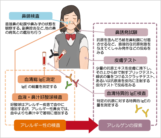 花粉症などのアレルギー性鼻炎で行われる主な検査